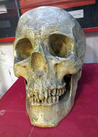Gipsabdruck des Sch&auml;dels von Franz Schneider im Wiener Kriminalmuseum.